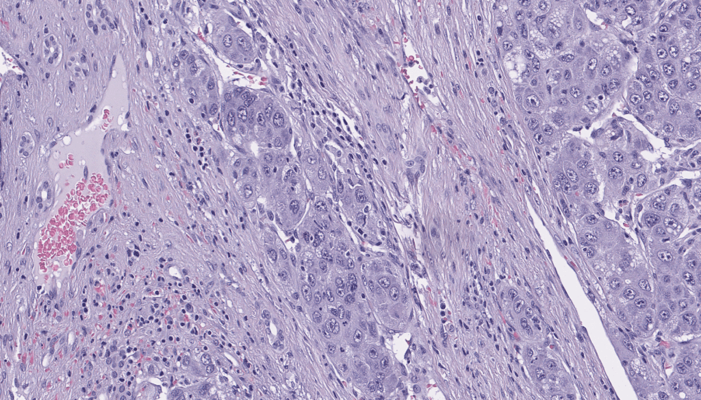 Multiplex Immunohistochemistry