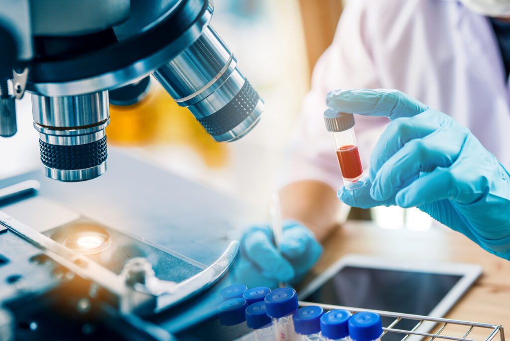 Lab technician analyzing a blood sample in a test tube.