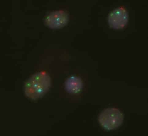 Bladder cancer probes_normal cells